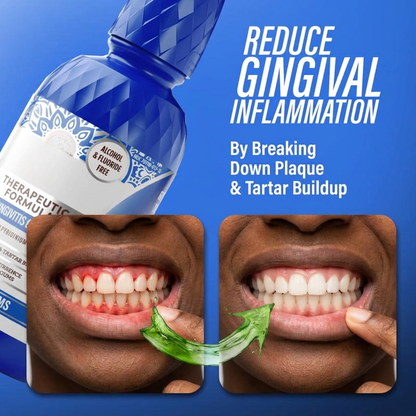 Anti-Gingivitis Oral Cleanse